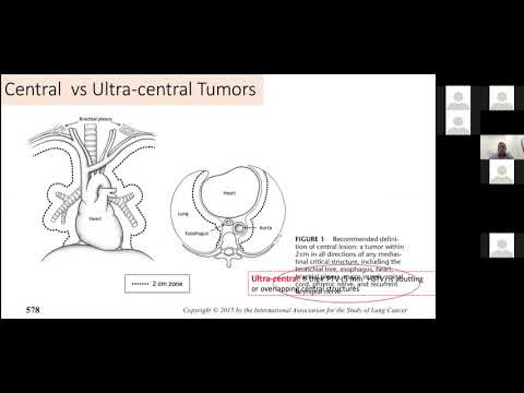  Lung Radiosurgery/SABR 